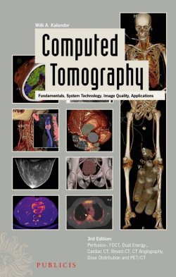 Книга "Computed Tomography. Fundamentals, System Technology, Image Quality, Applications" – 