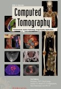 Computed Tomography. Fundamentals, System Technology, Image Quality, Applications ()