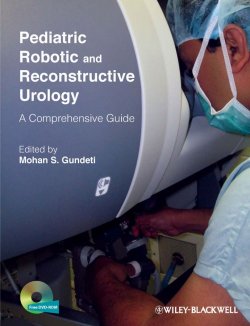 Книга "Pediatric Robotic and Reconstructive Urology. A Comprehensive Guide" – 