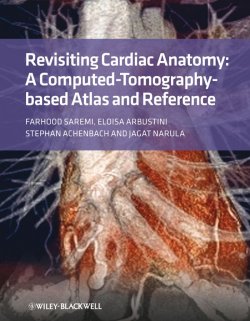 Книга "Revisiting Cardiac Anatomy. A Computed-Tomography-Based Atlas and Reference" – 