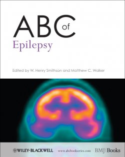 Книга "ABC of Epilepsy" – 