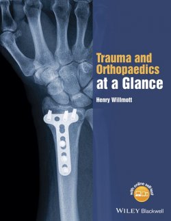 Книга "Trauma and Orthopaedics at a Glance" – 