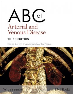 Книга "ABC of Arterial and Venous Disease" – 