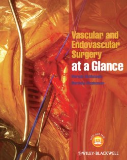 Книга "Vascular and Endovascular Surgery at a Glance" – 