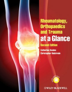 Книга "Rheumatology, Orthopaedics and Trauma at a Glance" – 