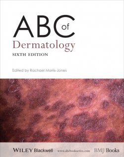 Книга "ABC of Dermatology" – 