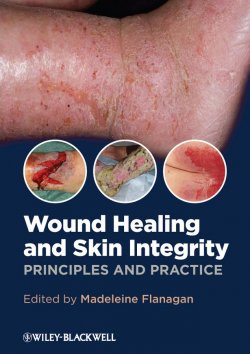Книга "Wound Healing and Skin Integrity. Principles and Practice" – 