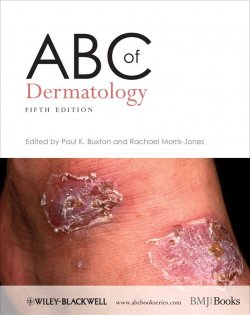 Книга "ABC of Dermatology" – 