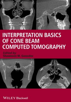 Книга "Interpretation Basics of Cone Beam Computed Tomography" – 