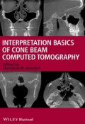 Interpretation Basics of Cone Beam Computed Tomography ()