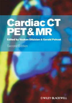 Книга "Cardiac CT, PET and MR" – 