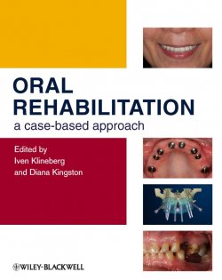 Книга "Oral Rehabilitation. A Case-Based Approach" – 