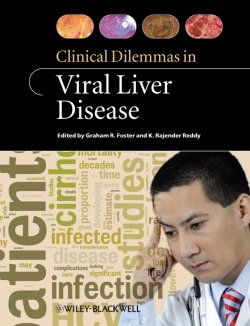 Книга "Clinical Dilemmas in Viral Liver Disease" – 