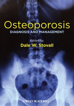 Книга "Osteoporosis. Diagnosis and Management" – 