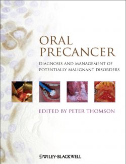 Книга "Oral Precancer. Diagnosis and Management of Potentially Malignant Disorders" – 