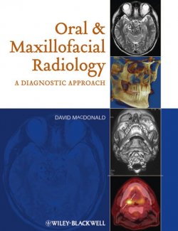 Книга "Oral and Maxillofacial Radiology. A Diagnostic Approach" – 