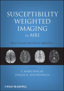 Книга "Susceptibility Weighted Imaging in MRI. Basic Concepts and Clinical Applications" – 