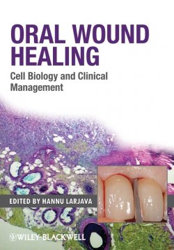 Книга "Oral Wound Healing. Cell Biology and Clinical Management" – 