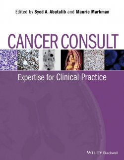 Книга "Cancer Consult. Expertise for Clinical Practice" – 