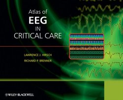Книга "Atlas of EEG in Critical Care" – 