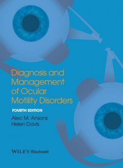 Книга "Diagnosis and Management of Ocular Motility Disorders" – 