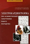 Электрокардиограмма при асимметричной гипертрофии левого желудочка (Т. В. Алексеева, В. В. Баранова, И. И. Баранова, 2009)