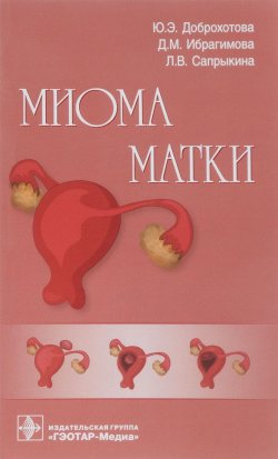 Книга "Миома матки. Руководство" – , 2018