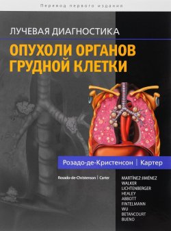 Книга "Лучевая диагностика. Опухоли органов грудной клетки" – , 2018