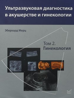 Книга "Ультразвуковая диагностика в акушерстве и гинекологии. Том 2. Гинекология" – , 2018