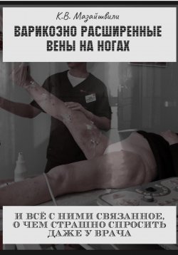 Книга "Варикозно расширенные вены на ногах и всё с ними связанное, о чём страшно спросить даже у врача" – Константин Мазайшвили, 2023