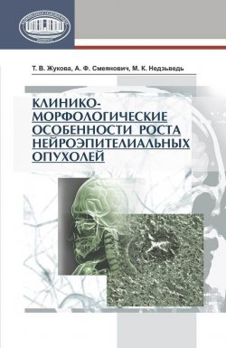 Книга "Клинико-морфологические особенности роста нейроэпителиальных опухолей" – Т. В. Жукова, 2013