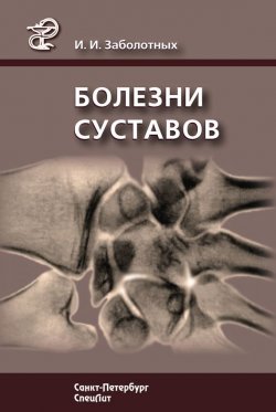 Книга "Болезни суставов" – Инга Заболотных, 2012