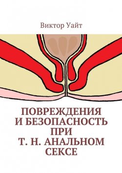 Книга "Повреждения и безопасность при т. н. анальном сексе" – Виктор Уайт