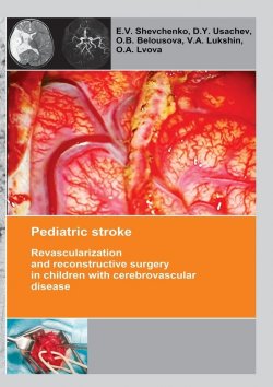 Книга "Pediatric stroke. Revascularization and reconstructive surgery in children with cerebrovascular disease" – V. E. Schwab, E. Shevchenko, V. Lukshin, D. Usachev, O. Belousova, O. Lvova