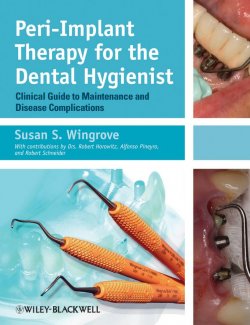 Книга "Peri-Implant Therapy for the Dental Hygienist. Clinical Guide to Maintenance and Disease Complications" – 