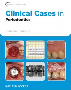 Книга "Clinical Cases in Periodontics" – 