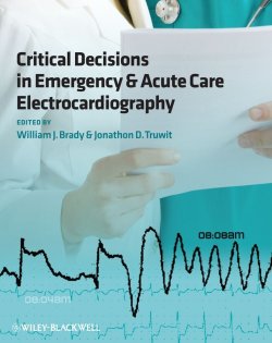 Книга "Critical Decisions in Emergency and Acute Care Electrocardiography" – 