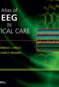 Atlas of EEG in Critical Care ()
