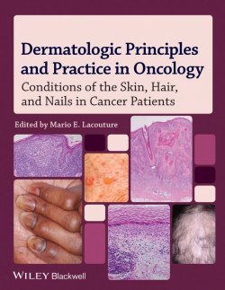 Книга "Dermatologic Principles and Practice in Oncology. Conditions of the Skin, Hair, and Nails in Cancer Patients" – 