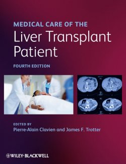 Книга "Medical Care of the Liver Transplant Patient" – 