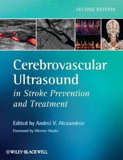 Книга "Cerebrovascular Ultrasound in Stroke Prevention and Treatment" – 