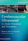 Cerebrovascular Ultrasound in Stroke Prevention and Treatment ()