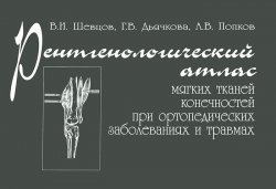 Книга "Рентгенологический атлас мягких тканей конечностей при ортопедических заболеваниях и травмах" – В. А. Попков, 1999