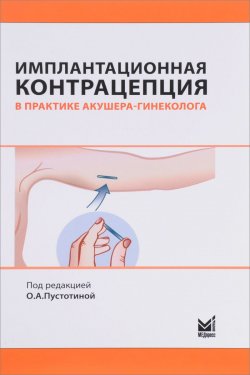 Книга "Имплантационная контрацепция в практике акушера-гинеколога" – Татьяна Обоскалова, 2017