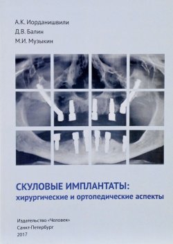 Книга "Скуловые имплантаты. Хирургические и ортопедические аспекты" – А. К. Иорданишвили, 2017