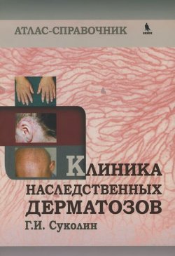 Книга "Клиника наследственных дерматозов. Атлас-справочник" – , 2014