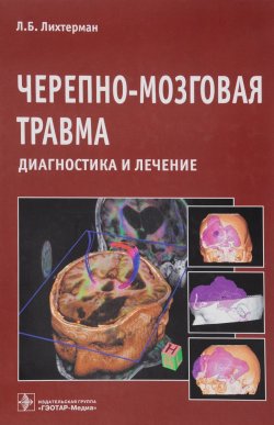 Книга "Черепно-мозговая травма. Диагностика и лечение" – , 2014