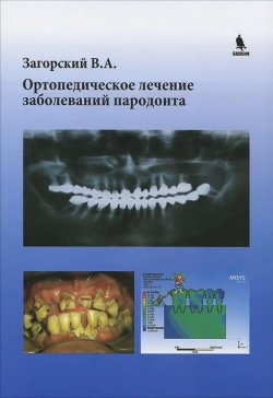 Книга "Ортопедическое лечение заболеваний пародонта" – , 2015