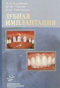 Зубная имплантация (А. Ф. Антипин, А. Ф. Шориков, и ещё 7 авторов, 2006)