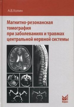 Книга "Магнитно-резонансная томография при заболеваниях и травмах центральной нервной системы" – , 2017